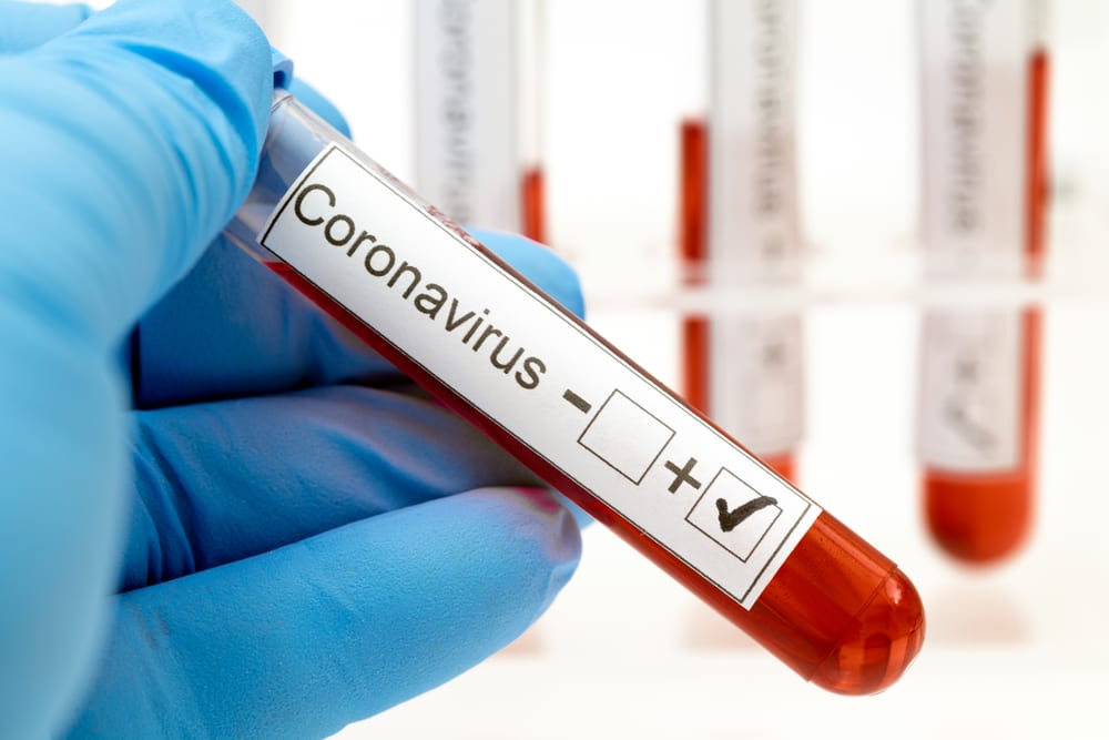 Can A Startup Fill The Coronavirus Testing Gap Pymnts Com