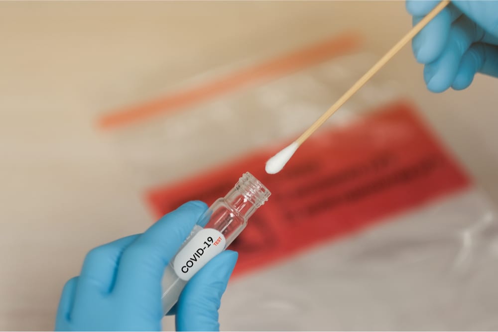 St. Louis Fed: Widespread Virus Testing Needed To Reopen US Economy