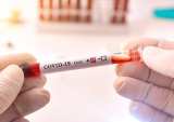 Bezos: Global Testing Needed To Combat COVID-19