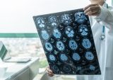 Medical Image Sharing Platform Aims to Put DVDs of MRIs on the Scrap Heap