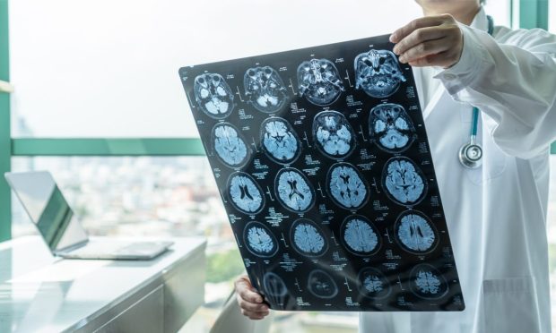 Medical Image Sharing Platform Aims to Put DVDs of MRIs on the Scrap Heap