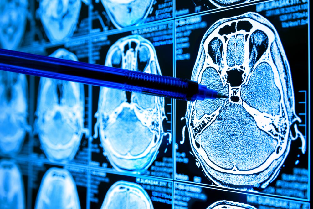 Healthcare Industry Could Be Generative AI’s Biggest Proving Ground 