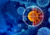 AI, cancer detection, healthcare